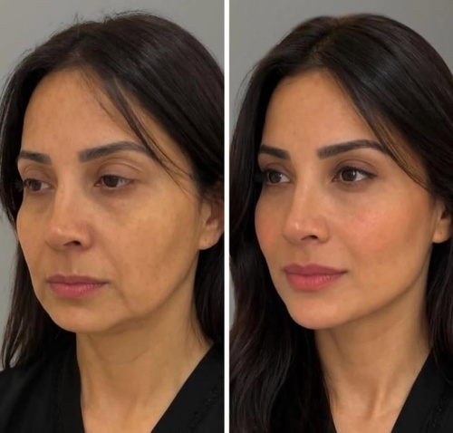 Caso Clínico 1 Antes e Depois